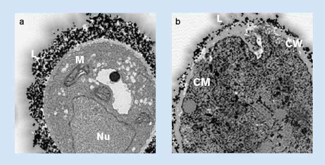 Cellular view of AmBisome at work